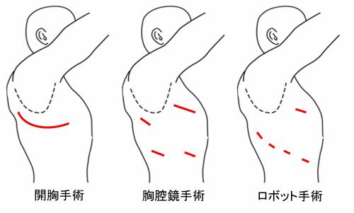 模式図1
