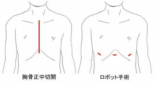 模式図2