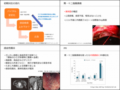 令和元年第７回消化器内科レクチャー